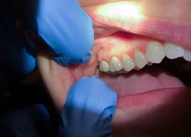 Best Emergency Gum Pain Relief  in Pocahontas, IA